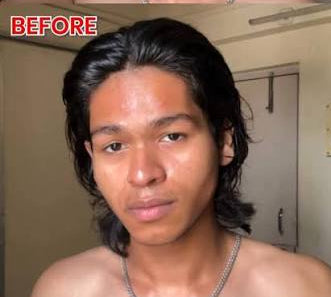 Before skincare results