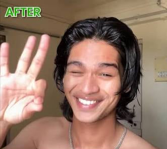 After skincare results